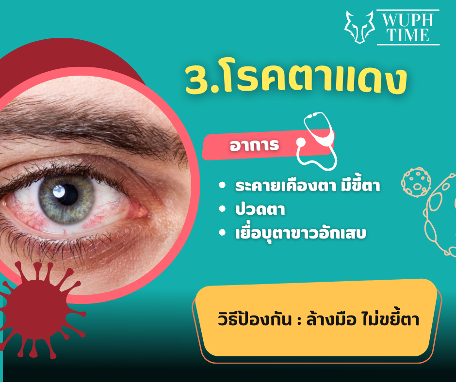 โรคตาแดง มีสาเหตุมาจากเชื้อไวรัส สามารถติดต่อได้ง่าย ในช่วงฤดูฝนที่มีน้ำท่วม อาการ : ระคายเคืองตา น้ำตาไหล ปวดตา มีขี้ตามาก เยื่อบุตาขาวอักเสบ วิธีป้องกัน: ล้างมือบ่อย ๆ ไม่ขยี้ตา